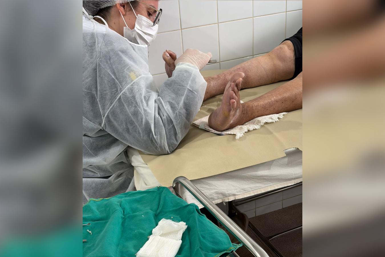 Curativos especiais passam a ser realizados nas unidades de saúde
